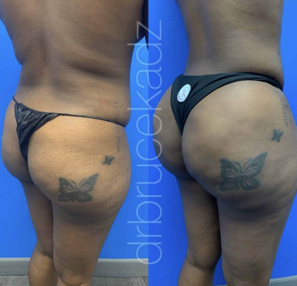 Ass brazilian big Latina Butt