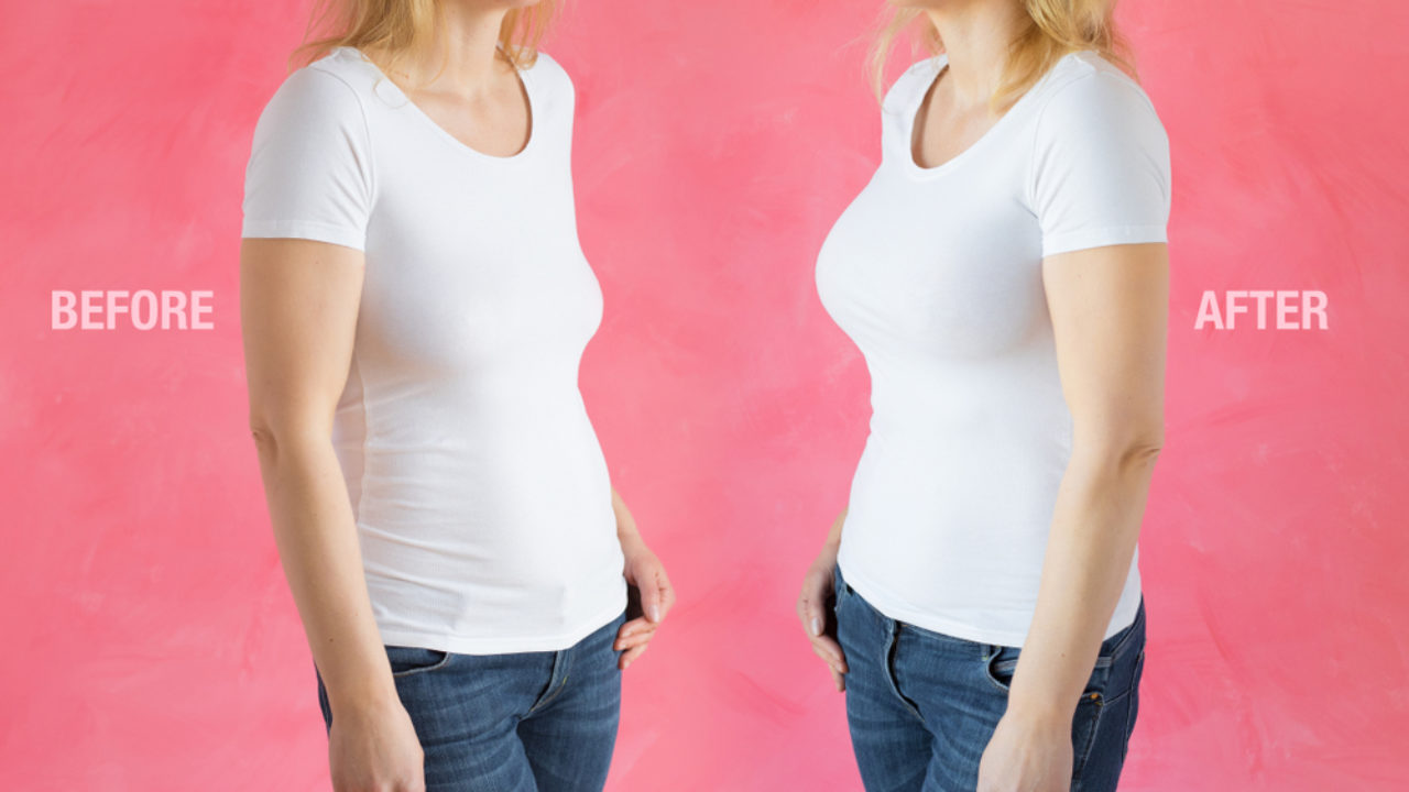 Study Finds: The Truth About Breast Lift & Cup Size - Dr. Izaddoost