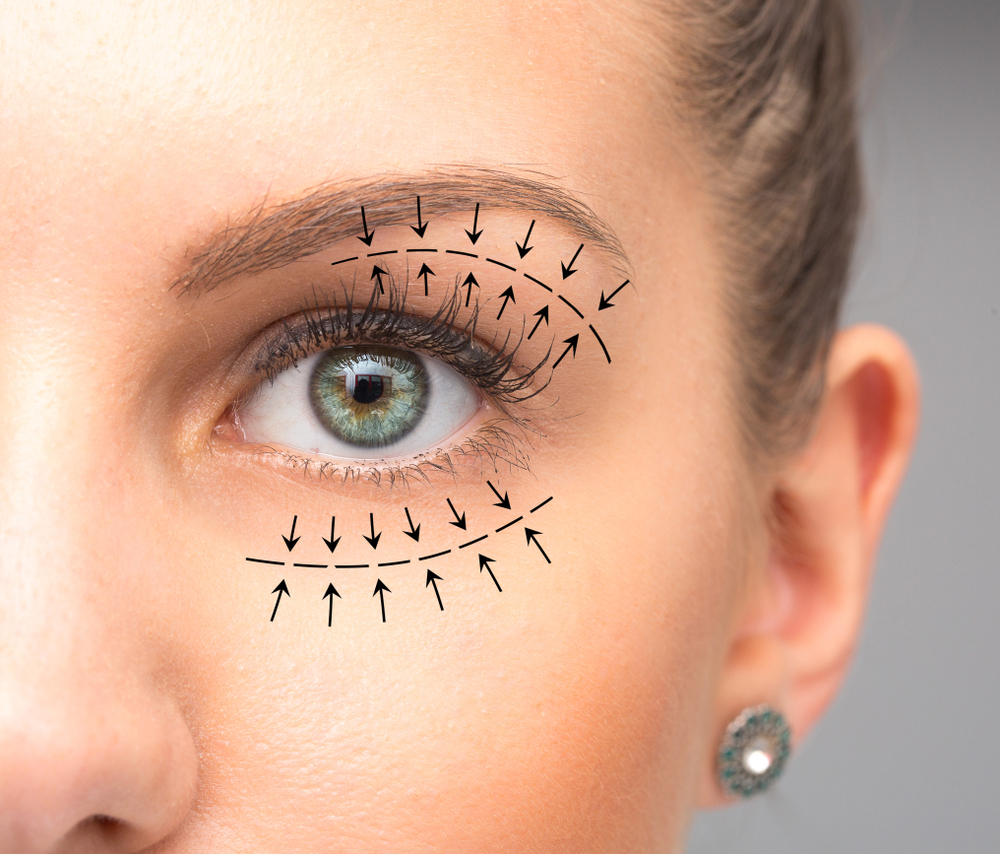 A Comprehensive Guide to Eyelid Surgery | Dr. Kadz