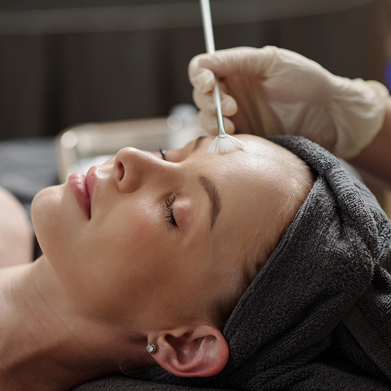 Woman getting a chemical peel