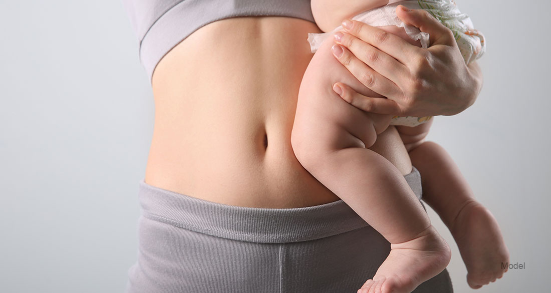 Dr. Bruce Kadz - Mommy Makeover Recovery, Week by Week