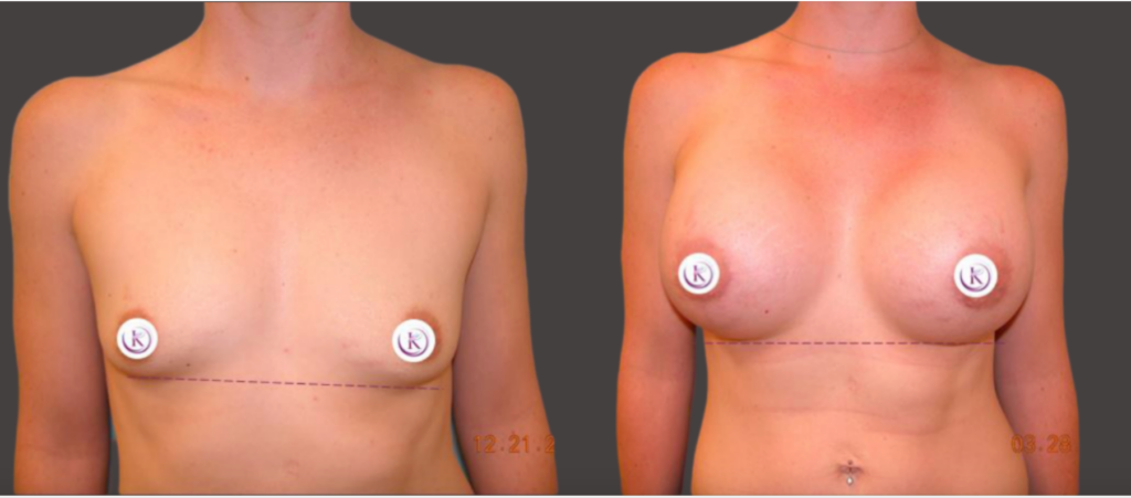 Actual patient results