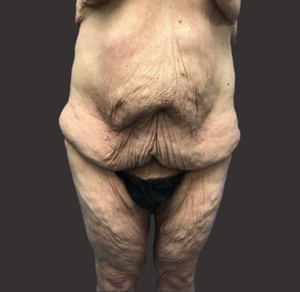 Case--2947-Male-Surgery | Before Male Surgery