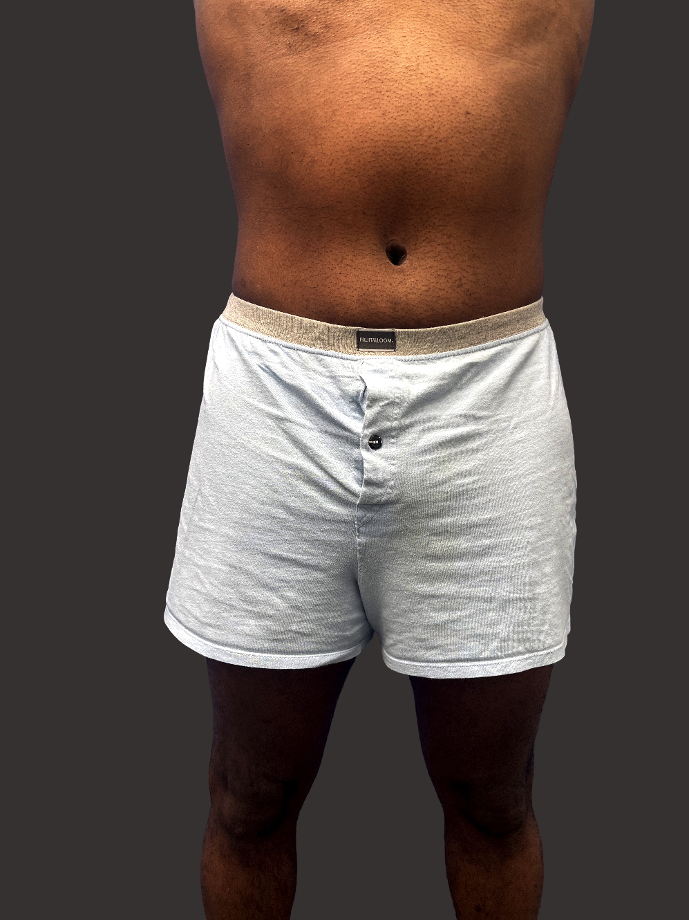 Case--4323-Male-Surgery | After Male Surgery