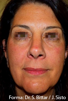 Case--9929-Forma | After Forma