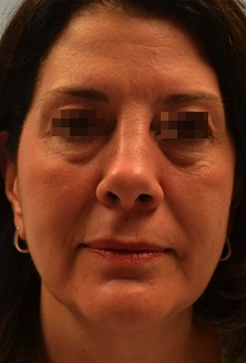 Case--9929-Forma | Before Forma