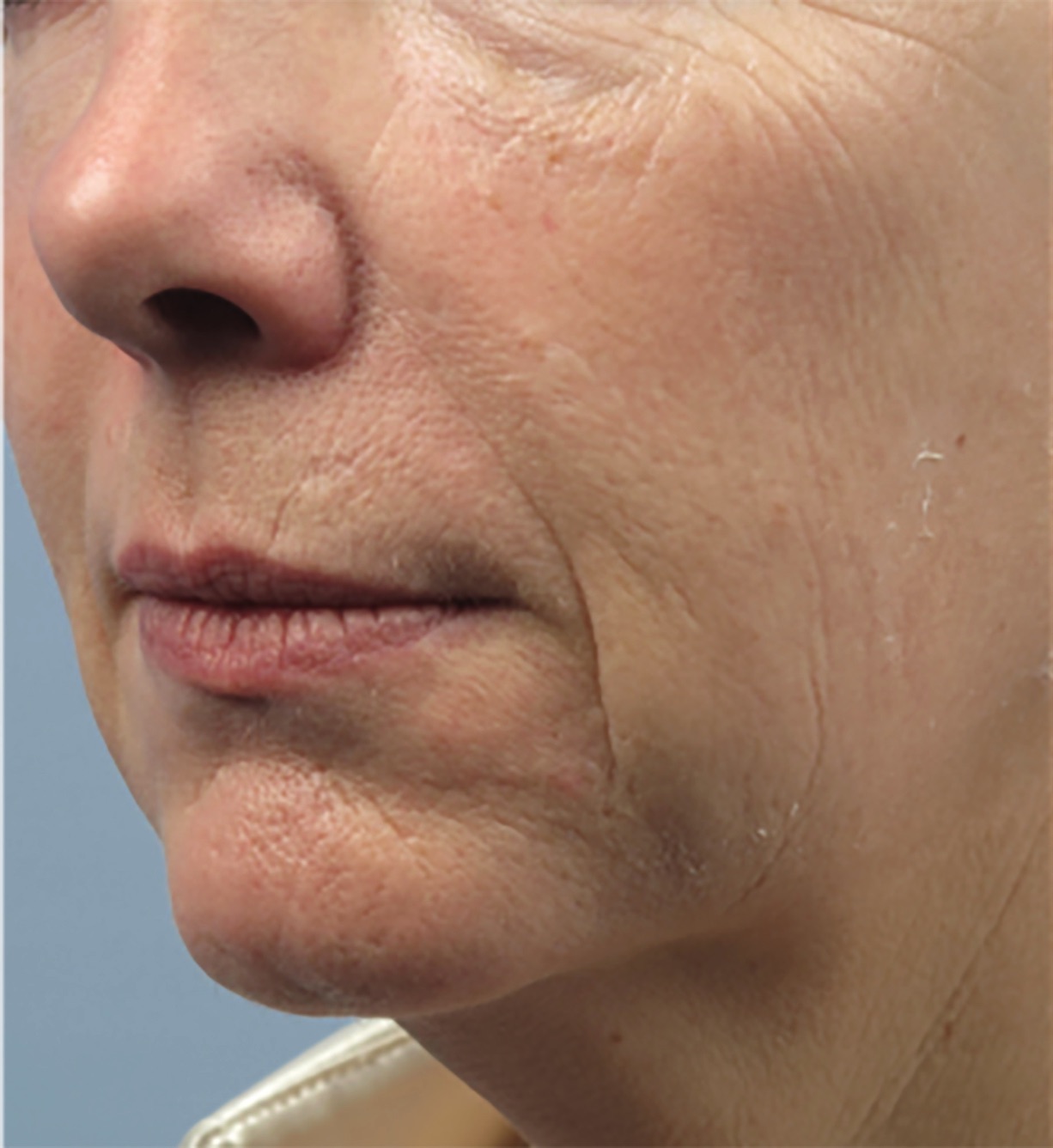 Case--9191-Forma | Before Forma