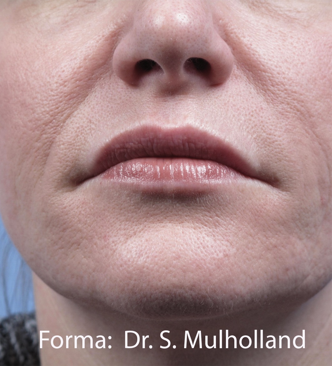 Case--2298-Forma | After Forma