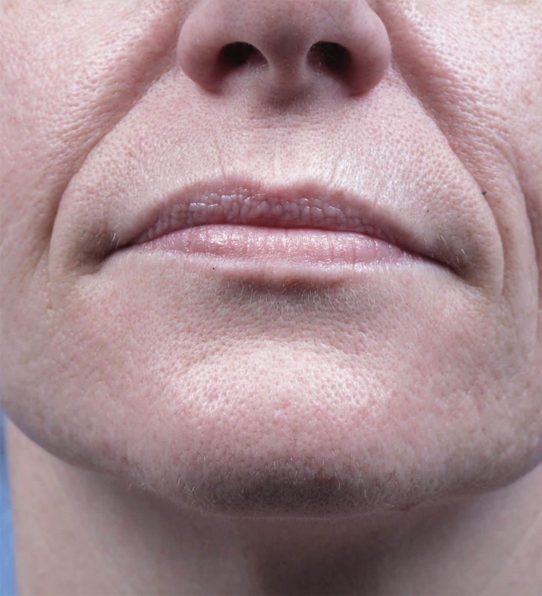 Case--2298-Forma | Before Forma