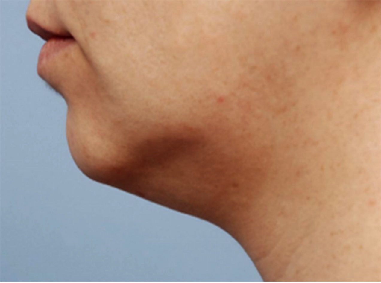 Case--6972-Forma | Before Forma