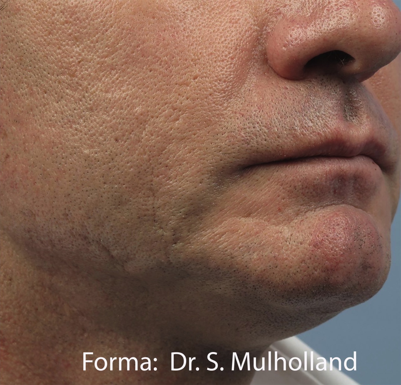 Case--6458-Forma | After Forma