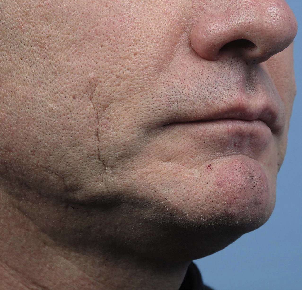 Case--6458-Forma | Before Forma