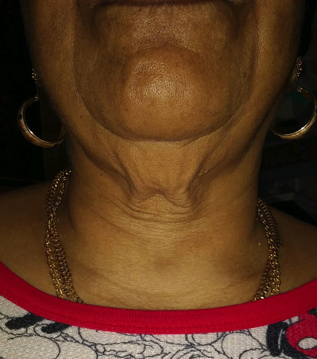 Case--7926-Forma | Before Forma