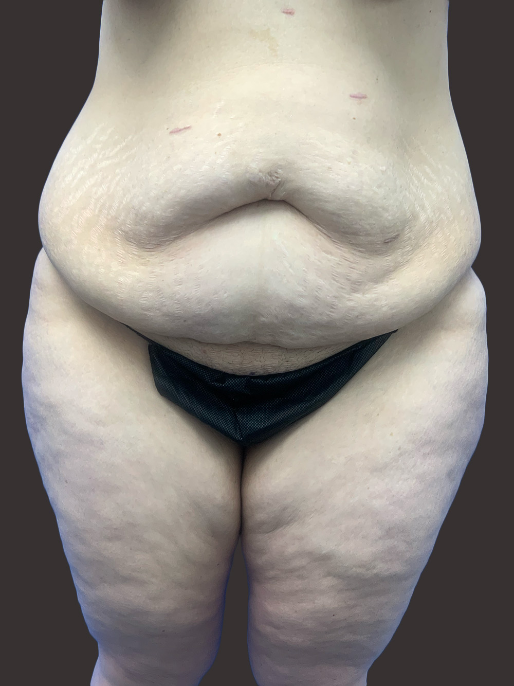 Case--6899 | Before Body